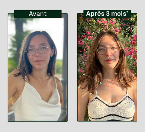 Before and after comparison of hair growth on a person's head, showing visible difference after 3 months.