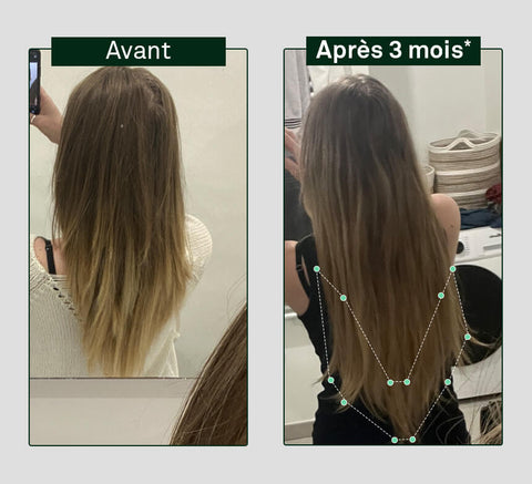 Before and after comparison of hair growth on a person's head, showing visible difference after 3 months.