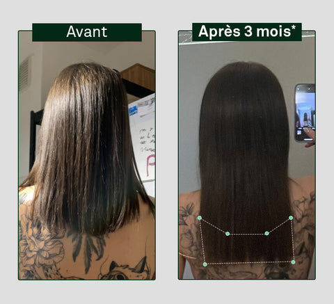 Before and after comparison of hair growth on a person's head, showing visible difference after 3 months.