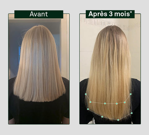 Before and after comparison of hair growth on a person's head, showing visible difference after 3 months.