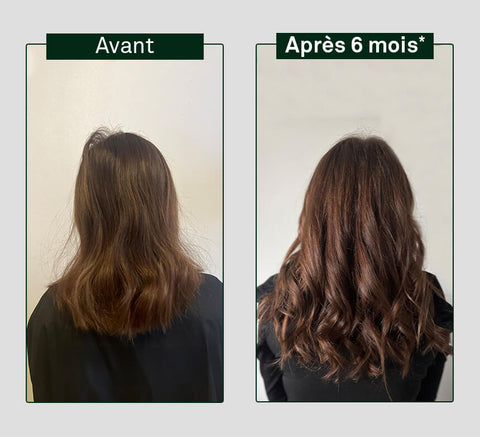 Before and after comparison of hair growth on a person's head, showing visible difference after six months.