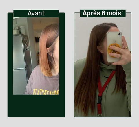 Before and after comparison of hair growth on a person's head, showing visible difference after six months.