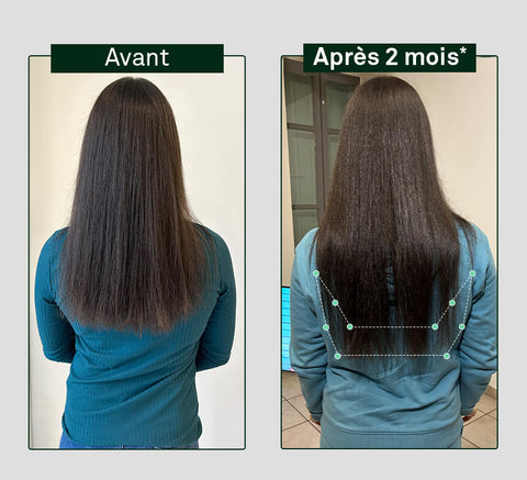 Before and after comparison of hair growth on a person's head, showing visible difference after 2 months.