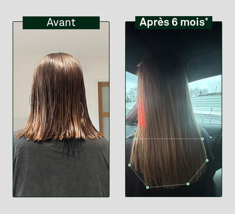 Before and after comparison of hair growth on a person's head, showing visible difference after six months.