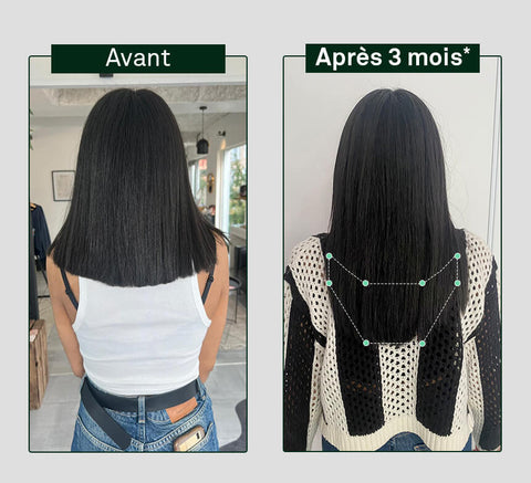 Before and after comparison of hair growth on a person's head, showing visible difference after 3 months.