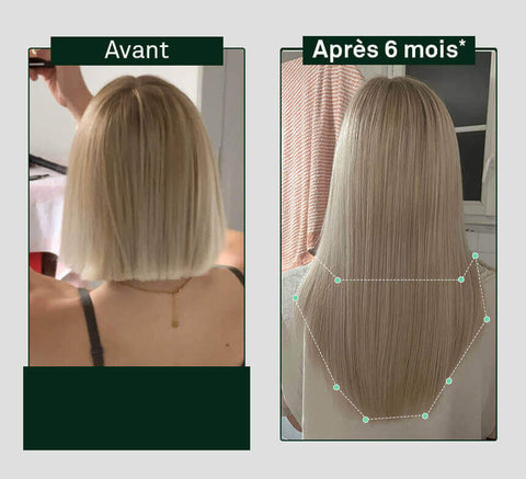 Before and after 3 months – back view showing longer, denser hair.